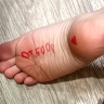 foot inspector